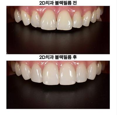 후기 사진 1