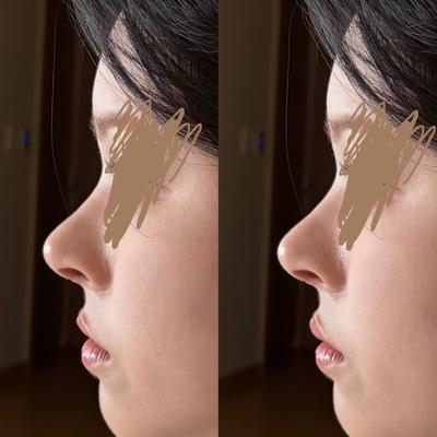 후기 사진 1
