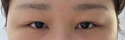 후기 사진 1