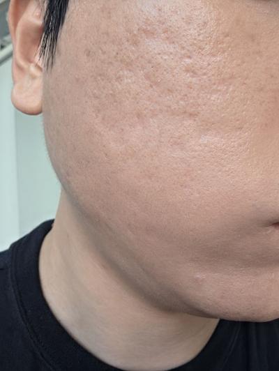 후기 사진 1