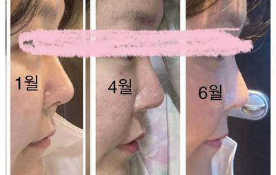 후기 사진 1