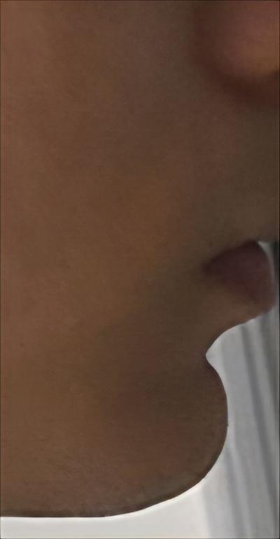후기 사진 2