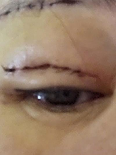 후기 사진 2