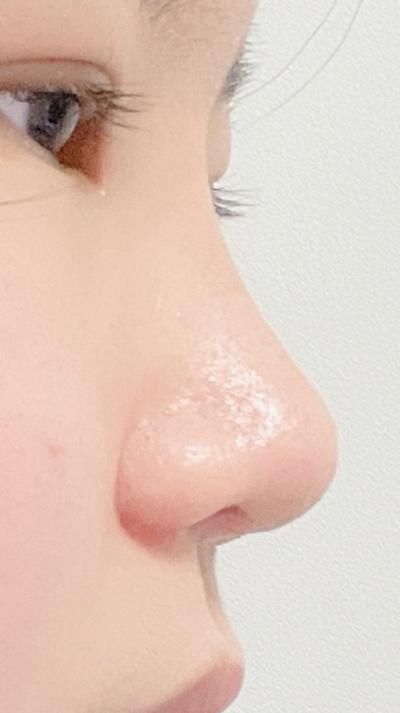 후기 사진 2