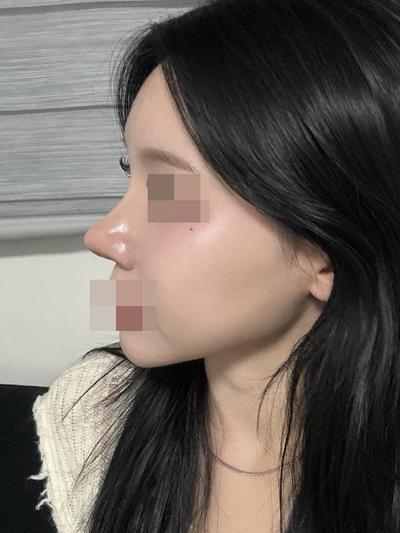 후기 사진 1