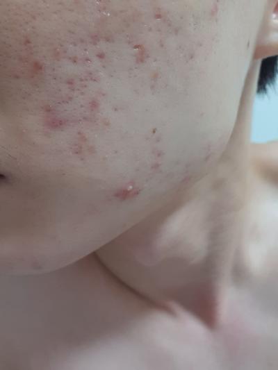후기 사진 1
