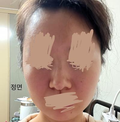 후기 사진 1