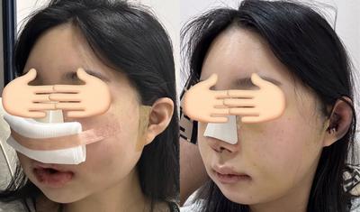 후기 사진 1