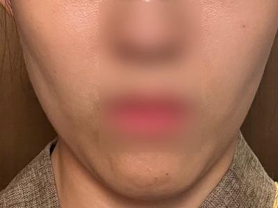 후기 사진 1