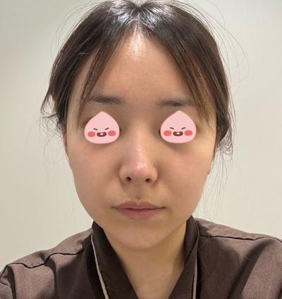 후기 사진 1