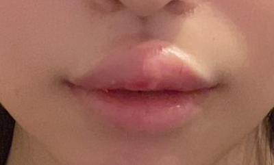 review_thumbnail_1