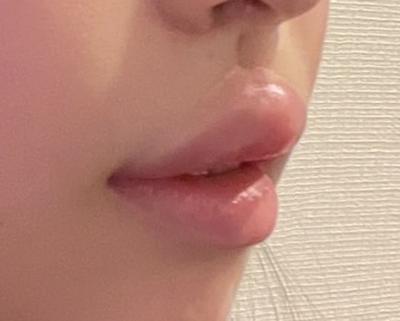 review_thumbnail_1