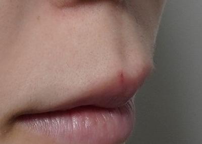 review_thumbnail_1