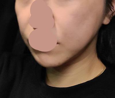 후기 사진 2