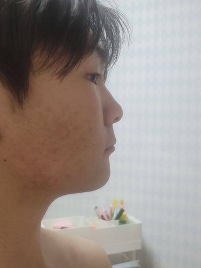 후기 사진 1