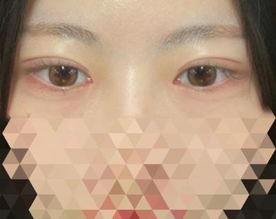 후기 사진 1