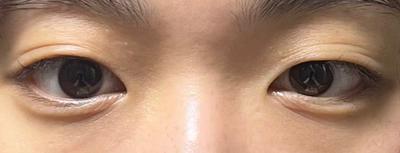 후기 사진 1