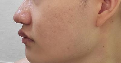 후기 사진 1