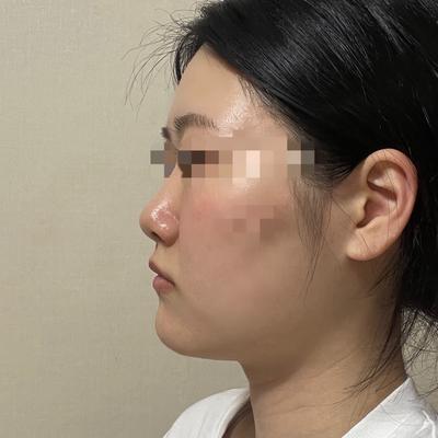 후기 사진 1