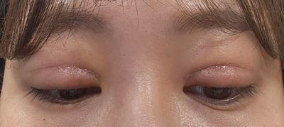 후기 사진 1