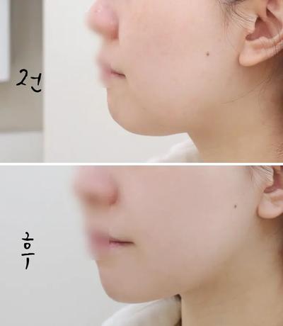 후기 사진 1