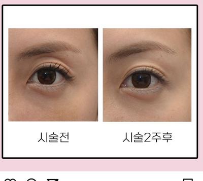 후기 사진 1