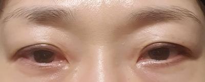 후기 사진 1