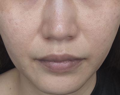후기 사진 1