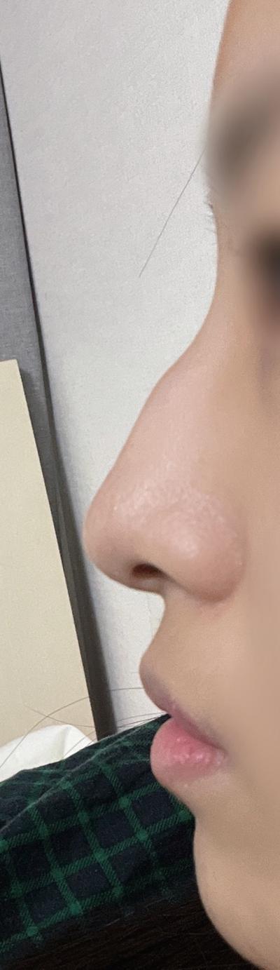 후기 사진 1
