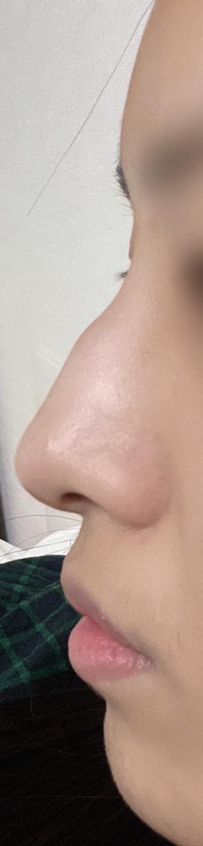 후기 사진 2