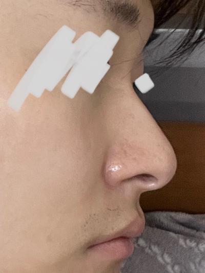 후기 사진 1