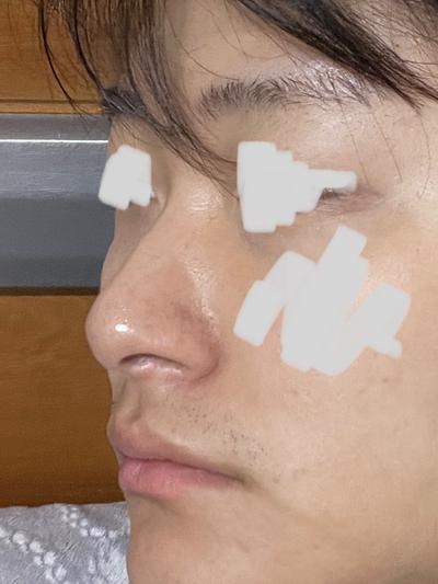 후기 사진 2