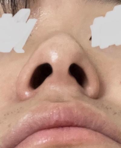 후기 사진 4