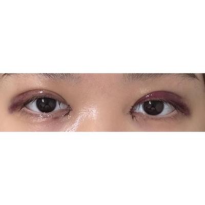 후기 사진 2