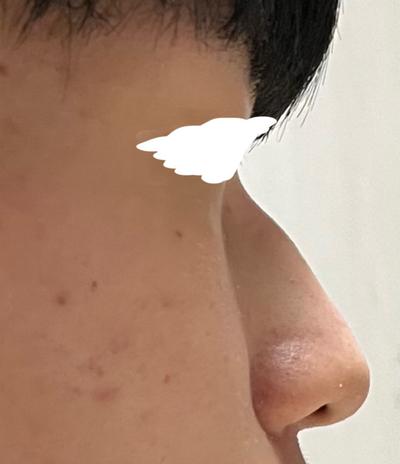 후기 사진 2