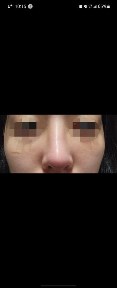 후기 사진 1