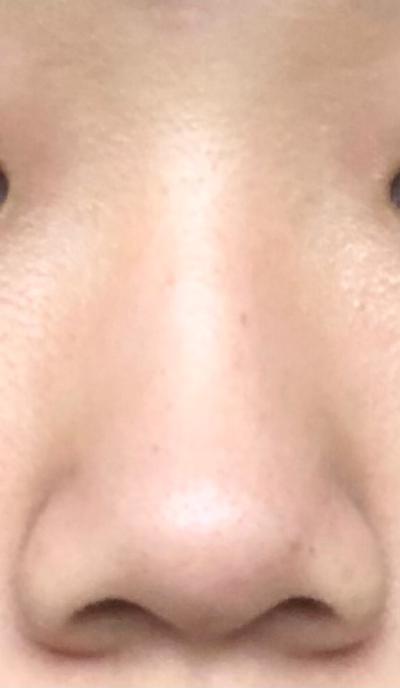 후기 사진 1