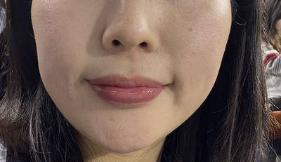 후기 사진 1