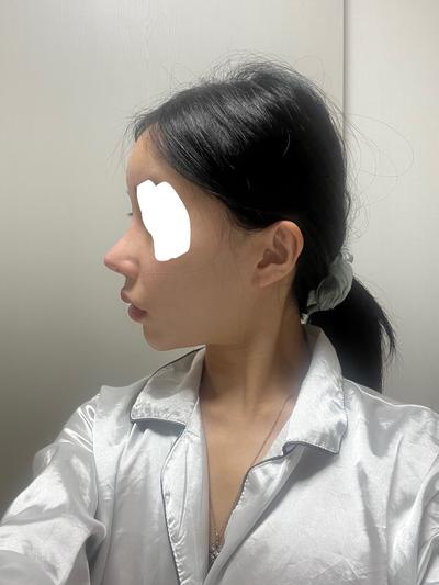 후기 사진 2