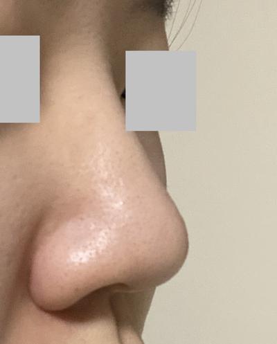 후기 사진 2
