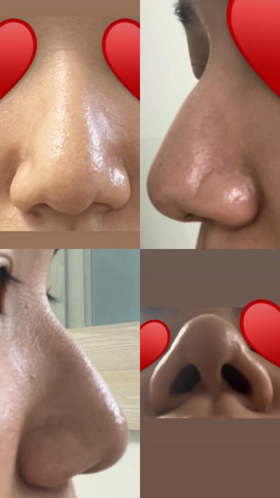 후기 사진 1
