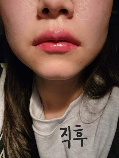 후기 사진 1