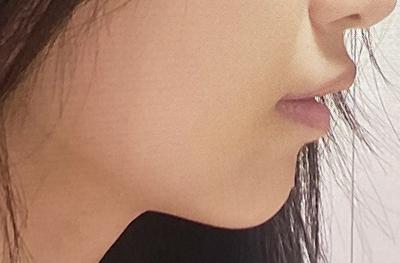 후기 사진 2