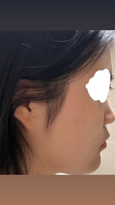 후기 사진 1