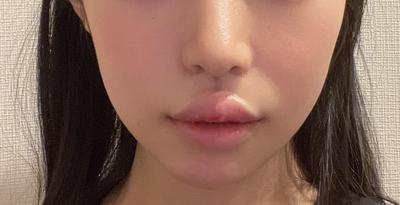 후기 사진 1