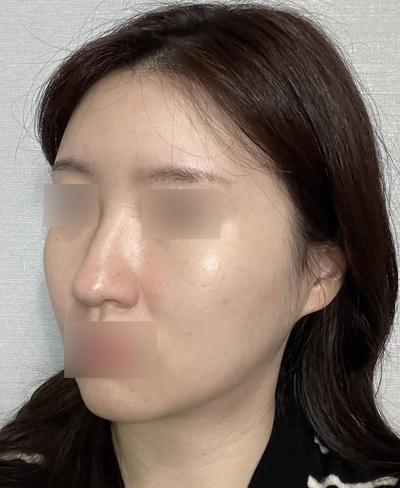 후기 사진 2