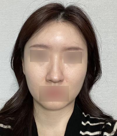 후기 사진 1