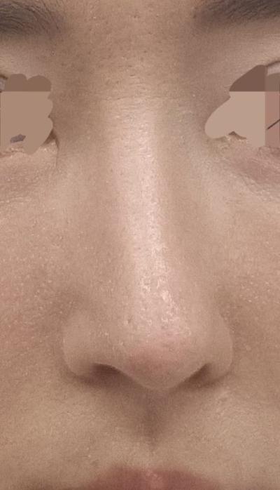 후기 사진 2