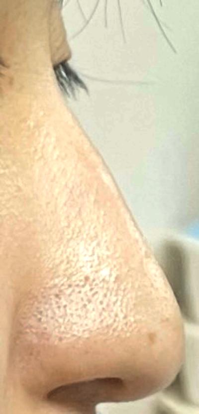 후기 사진 1