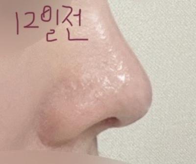 후기 사진 6